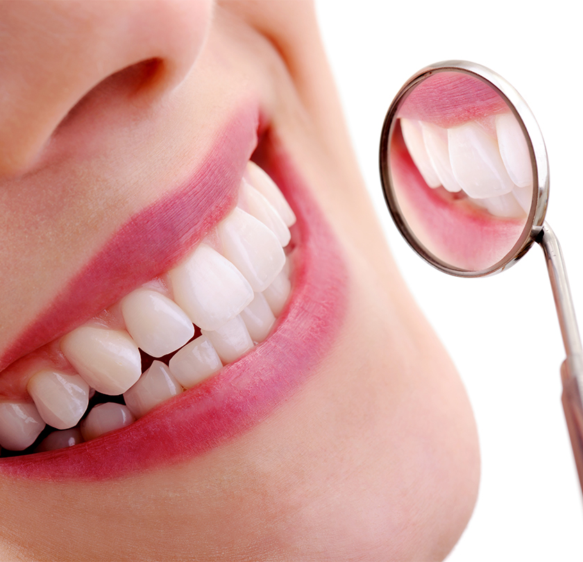 Pearly Whites Lifestyle Benefits